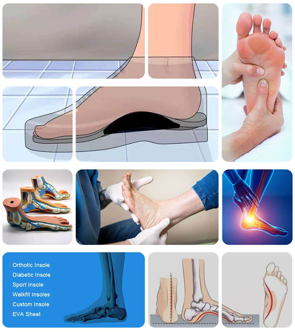 Ideastep New inner soles for shoes manufacturers for Foot shape correction