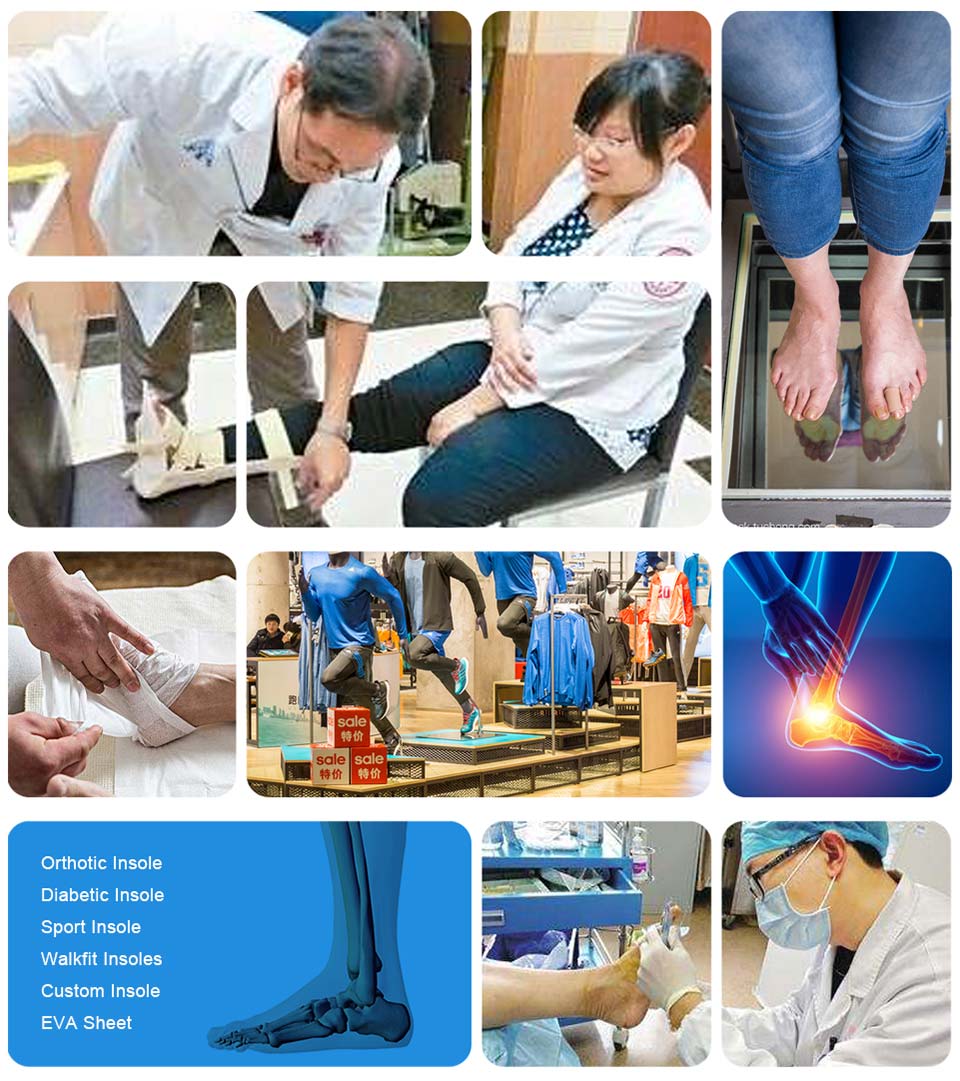 Custom orthopedic foot pads factory for Foot shape correction