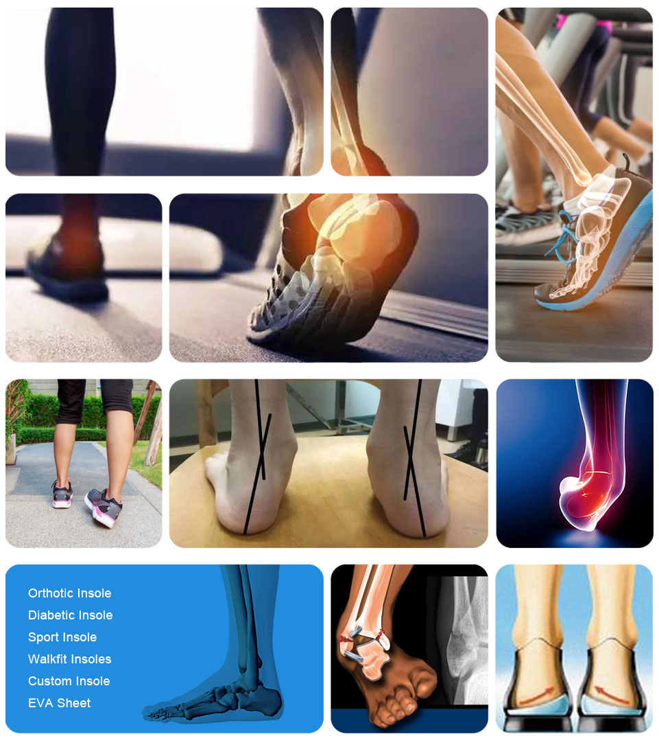 Ideastep custom made shoe inserts orthotics manufacturers for Foot shape correction