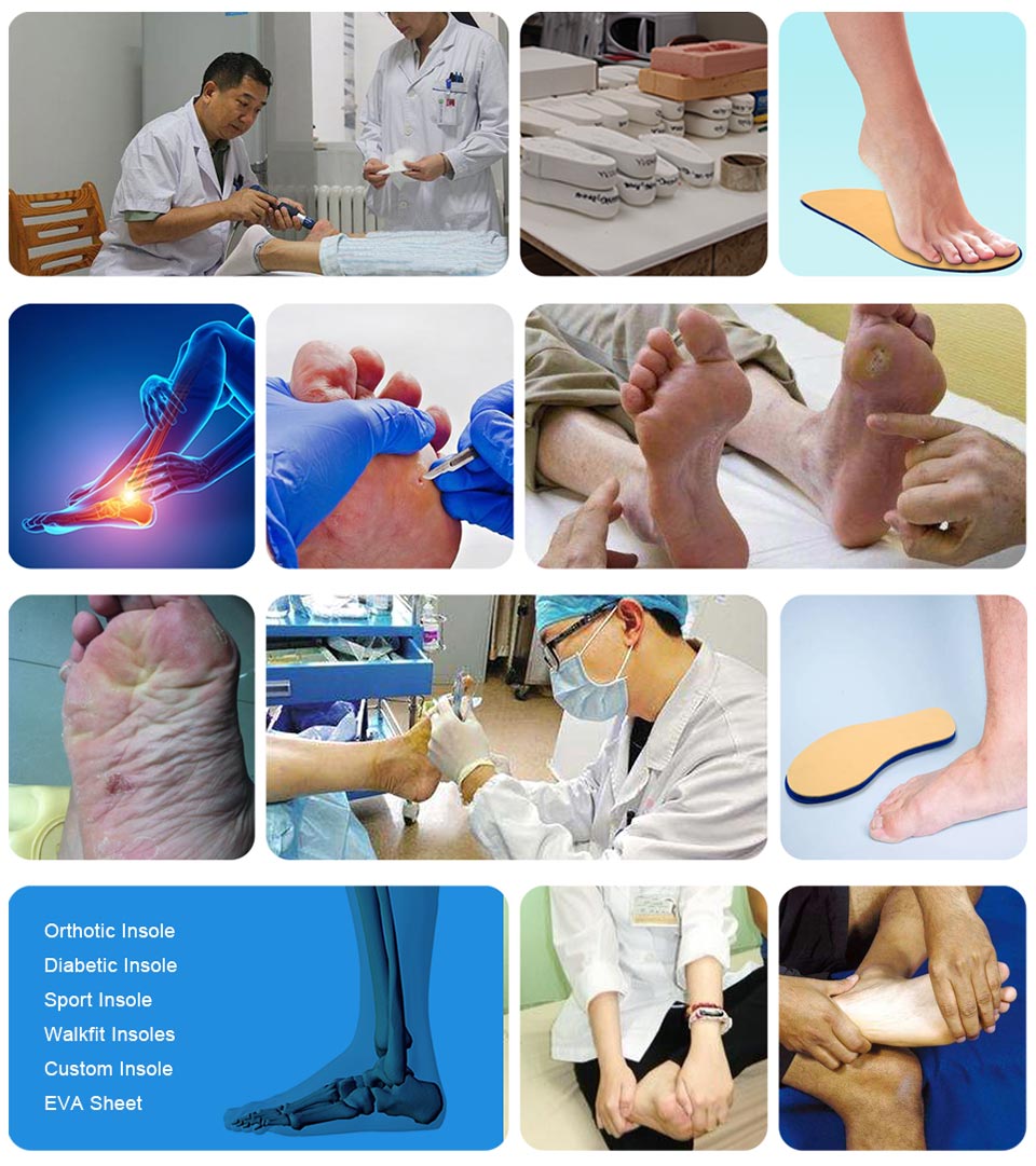 Ideastep best inserts for foot pain for business for Shoemaker