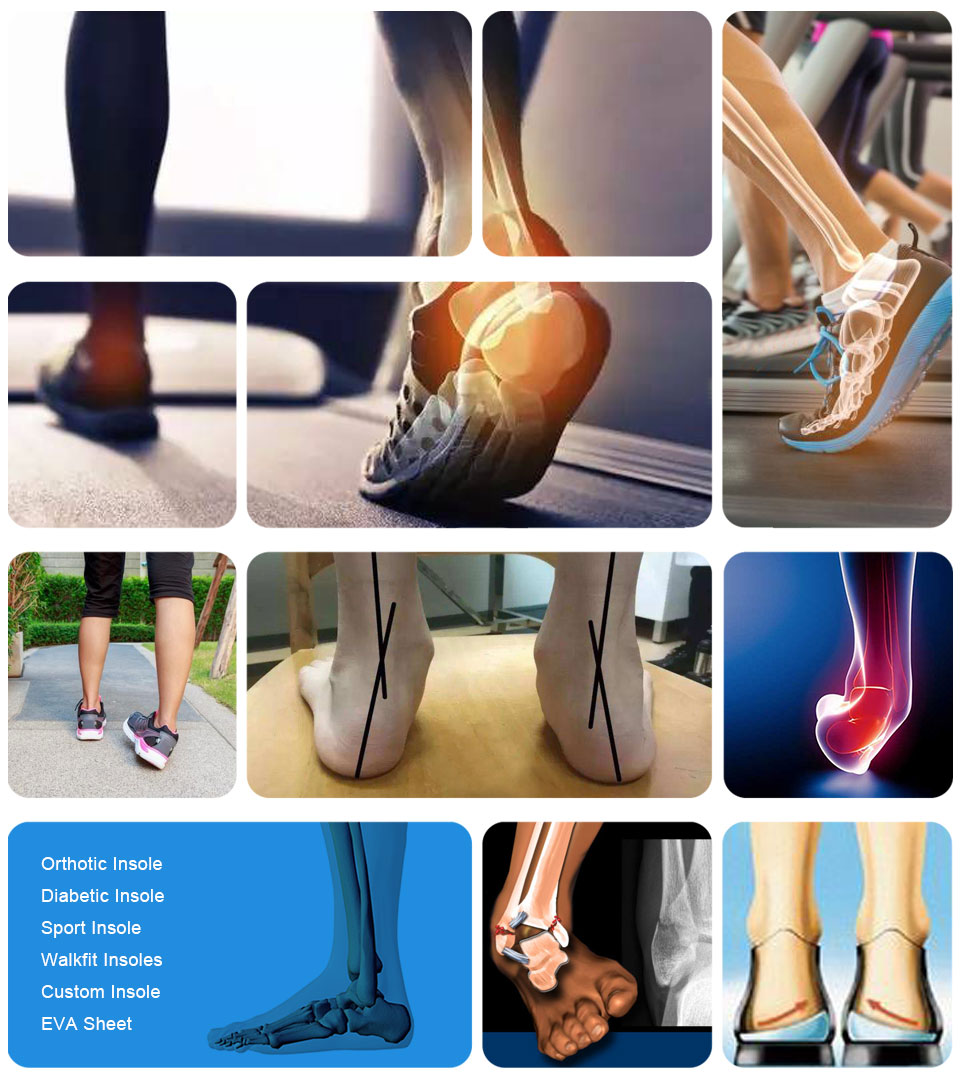 Ideastep Top orthotic materials suppliers for business for shoes manufacturing