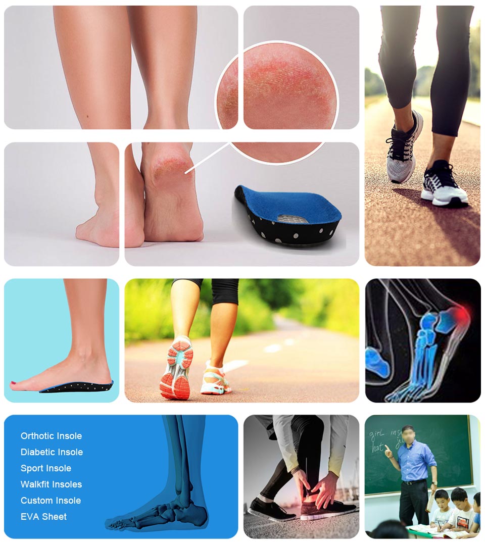 Ideastep New best orthotics for plantar fasciitis for business for Foot shape correction