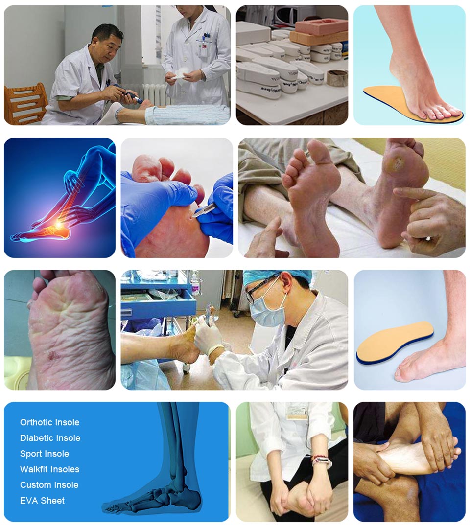 Ideastep Custom orthopaedic insoles for plantar fasciitis company for Foot shape correction